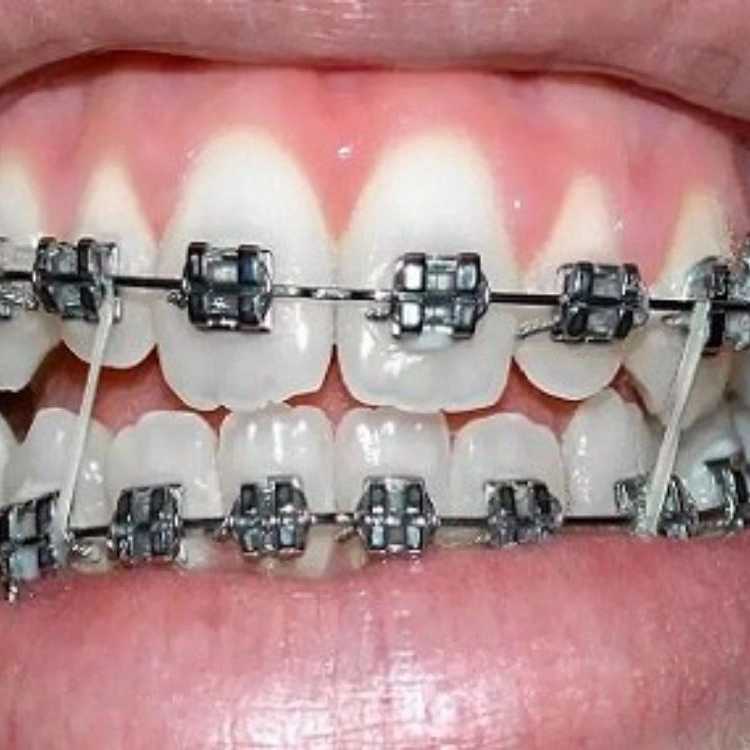 1748768627969.webp